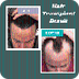 PRP Hair Loss Treatment - Marm