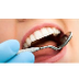 Best Dental Implant Treatment 
