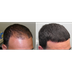Understand The Causes of Hair