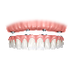 dental implant cost Melbourne