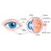 Ogen: oogziekten - aandoeninge