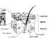 Basal and Squamous Cell