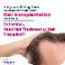 PRP Hair Loss Treatment - Marm