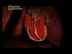 Fibrilación ventricular