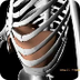 3D view of diaphragm 