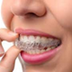 How much does Invisalign Treat