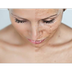 Know All About Microdermabrasi