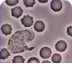 White Blood Cell Chases Bacter