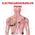 EKG EN PRONO