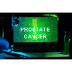 Detection of Prostate Cancera