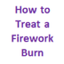 How to Treat a Fireworks Burn