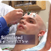 ECT Electroconvulsive Therapy 