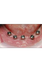 Best Cosmetic Dentist in Delhi