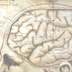 Neuro & Spine de Nayarit | Neu