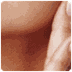Breast Lift