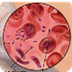 Malaria Prevention