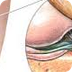 Youth Track Injuries