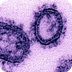 1918 Flu Pandemic 