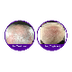 Avoid Hair Loss By Treatment