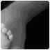 parent report newborn