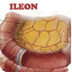 Ileon