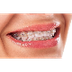 Find the Best invisalign in Me