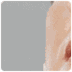 Botox Injections