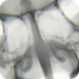Eskeletoa