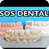 Tipos de Yeso dentales