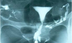 Infertility Testing - Reviva I