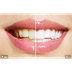Cosmetic & Laser Dentistry Eas