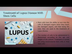 How Lupus Can Be Treated Effec