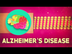 What is Alzheimer's disease? -