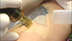 Specialist Tattoo Removals Syd