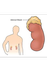 Insuficiencia suprarrenal
