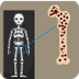 Qué es la Osteoporosis