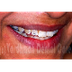 Maintain Your Oral Hygiene Wit
