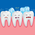 Hipersensibilidad dentinaria