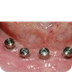 Best Dentist in Delhi - Dr. At